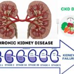 CKD DIET