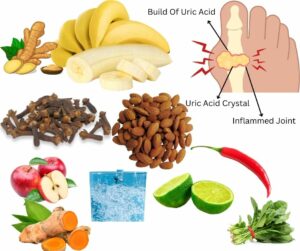 Uric Acid Diet Chart